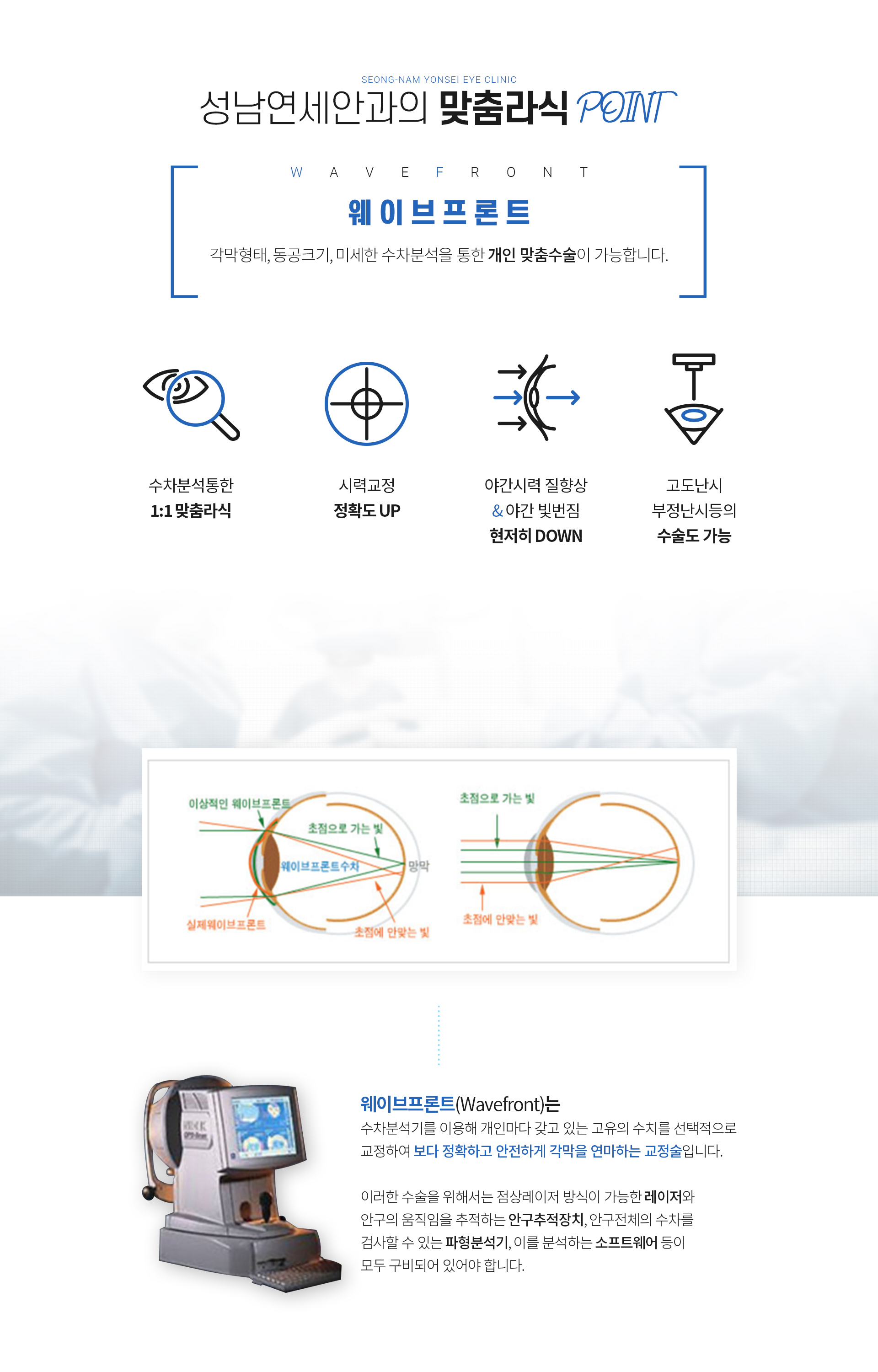 시술설명 맞춤라식 포인트